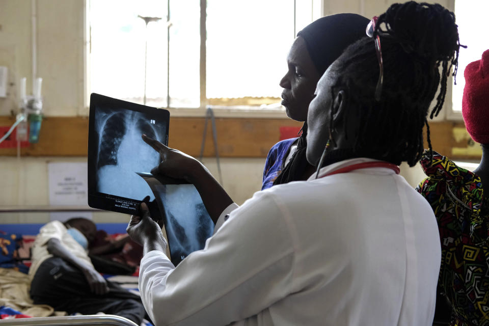 Julian Abeso looks at a sickle cell patient's x-ray image at the Mbale Regional Referral Hospital, Uganda Wednesday, April. 24, 2024. (AP Photo/Hajarah Nalwadda)
