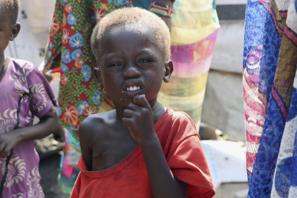 In this Thursday Dec. 17 2020 photo, three-year-old Peter Sebit stands outside a health clinic in Pibor, South Sudan, waiting to get food supplements. South Sudan is one of four countries with areas that could slip into famine, the United Nations has warned, along with Yemen, Burkina Faso and northeastern Nigeria.(AP Photo/Sam Mednick)