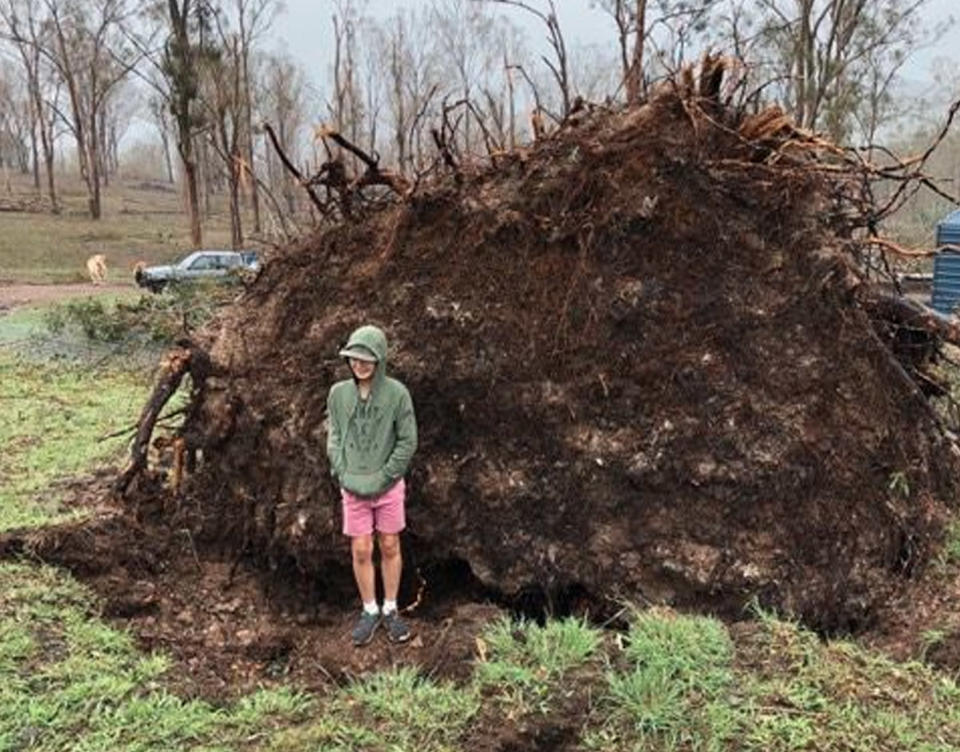Connor Creagh was crushed by a fallen tree that had sprung back up in a freak accident in Kingaroy following severe storms last October. Source: RACQ LifeFlight