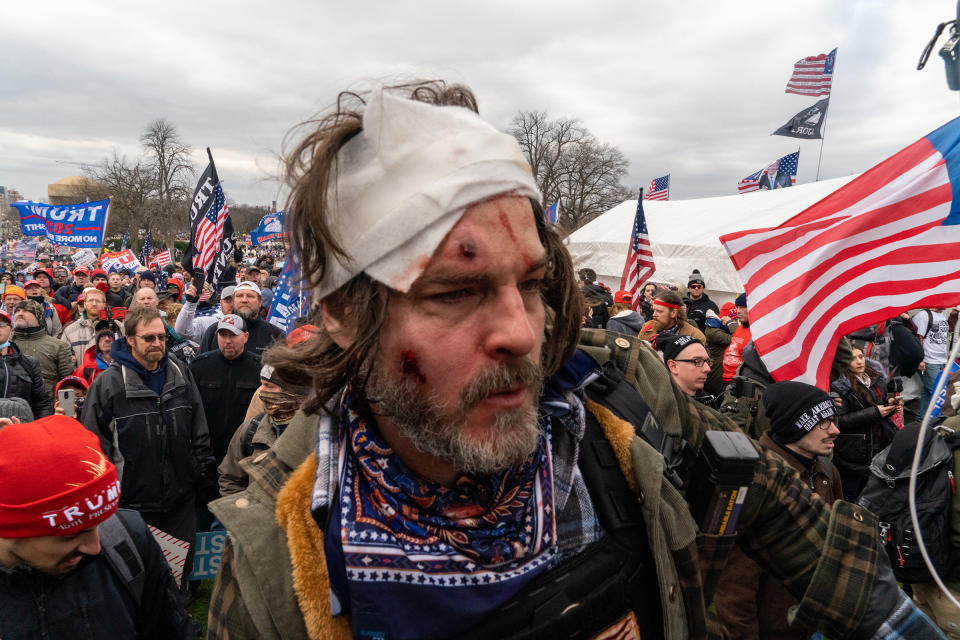 An injured pro-Trump supporter outside the Capitol building after clashes with police and security forces in Washington D.C., on Jan. 6.<span class="copyright">Peter van Agtmael—Magnum Photos for TIME</span>