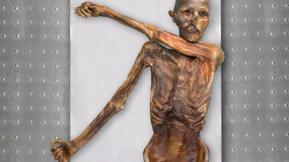A torso and head of human mummified remains.