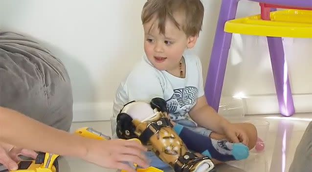 The little boy was born with a rare condition affecting bone growth in his right leg. Source: 7 News