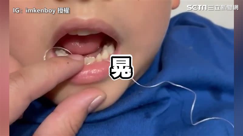 日前一名網友在臉書上分享，因小孩到了換牙期牙齒開始有些鬆動。（圖／IG：imkenboy 授權）