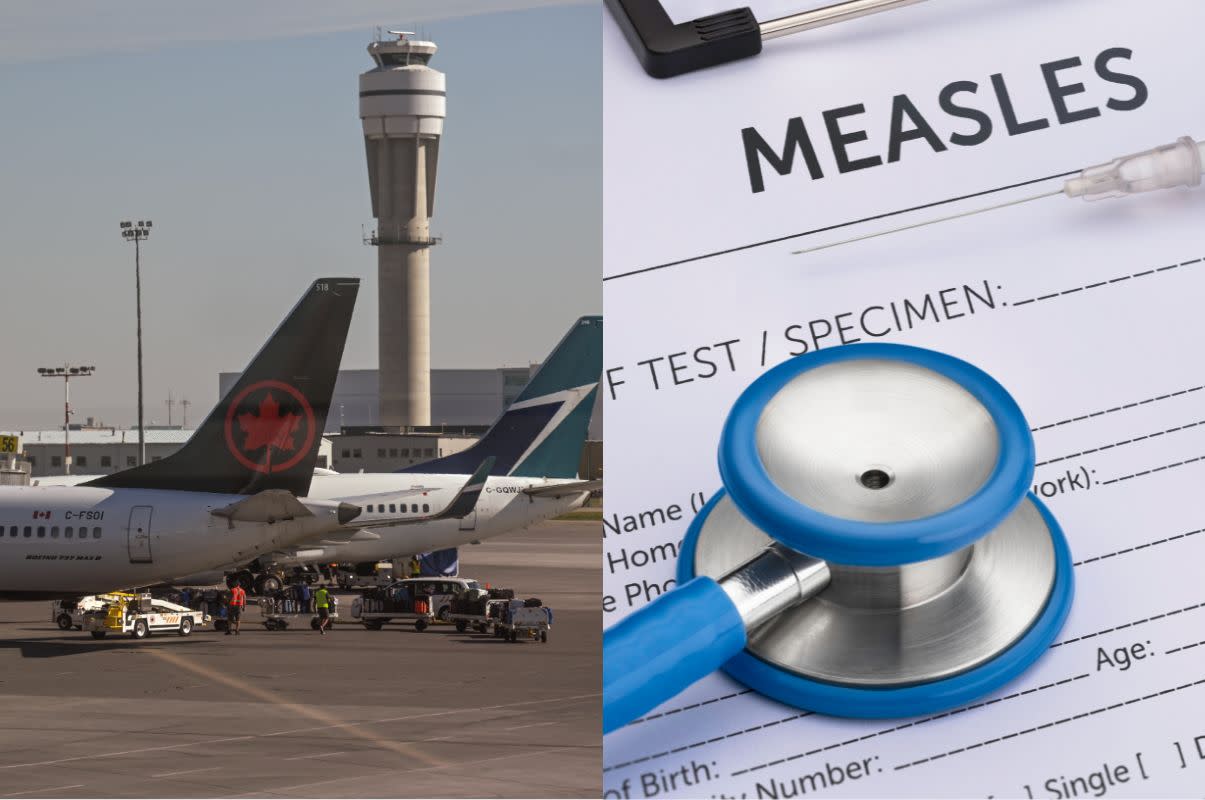 A case of measles was confirmed in Calgary, and the city's airport is one of the exposure sites. (Photo: Artur Widak/NurPhoto via Getty Images; Canva)