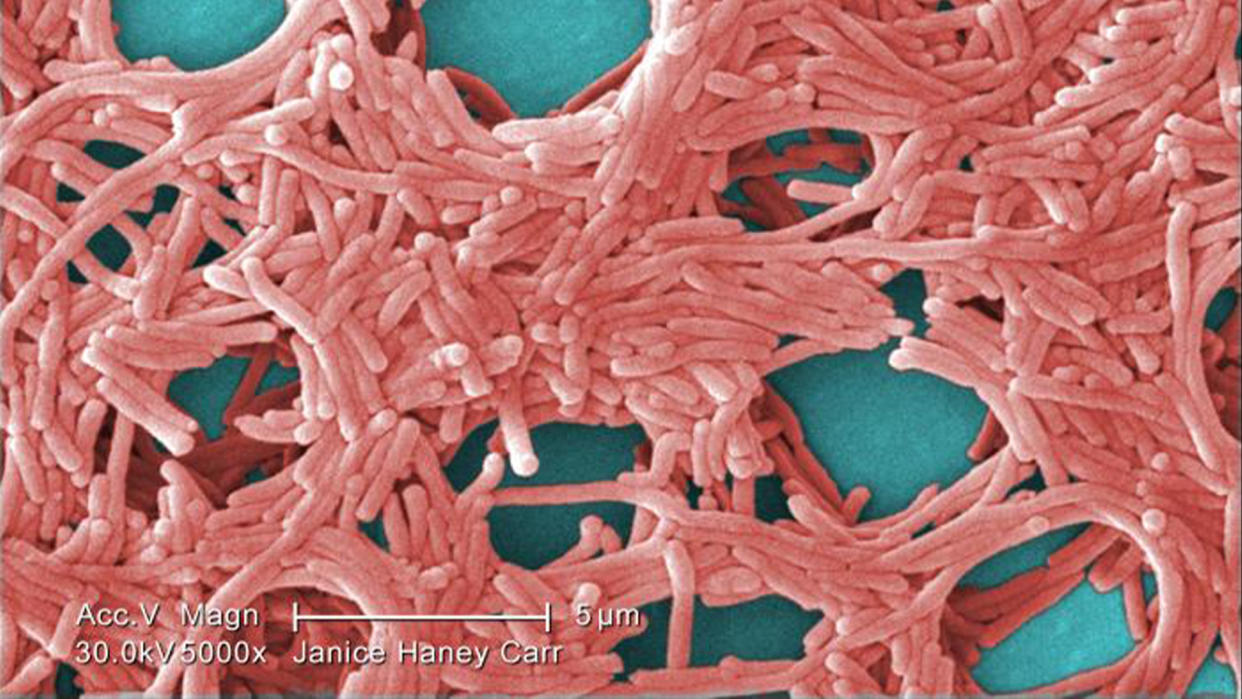  A magnetized image of the bacteria that cause Legionnaires' disease, which are rod-shaped and depicted in pink. 