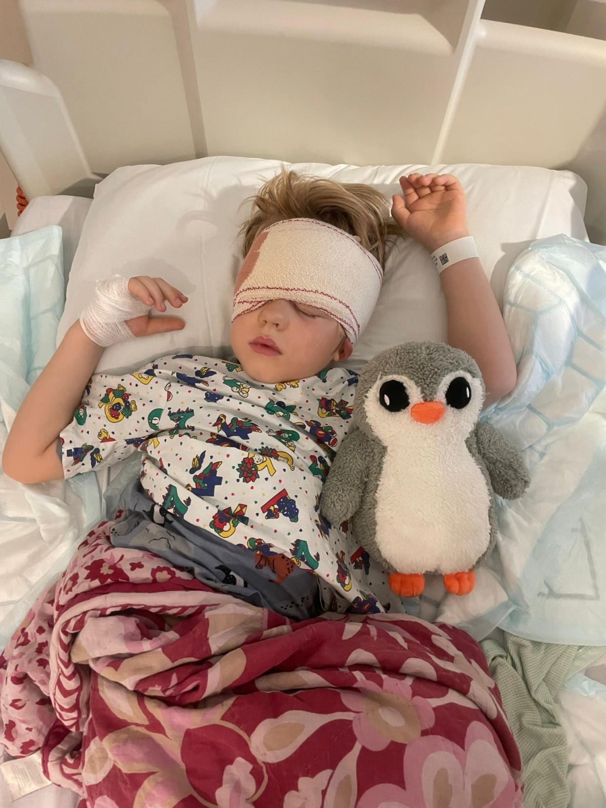 Arlo has had surgery to remove his eye and four rounds of chemotherapy. (The Childhood Eye Cancer Trust/SWNS)