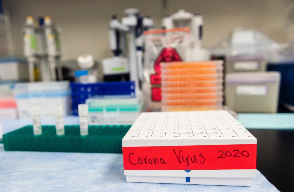 Three potential coronavirus, COVID-19, vaccines are kept in a tray at Novavax labs in Rockville, Maryland on March 20, 2020, one of the labs developing a vaccine for the coronavirus, COVID-19. (Photo by ANDREW CABALLERO-REYNOLDS / AFP) (Photo by ANDREW CABALLERO-REYNOLDS/AFP via Getty Images)