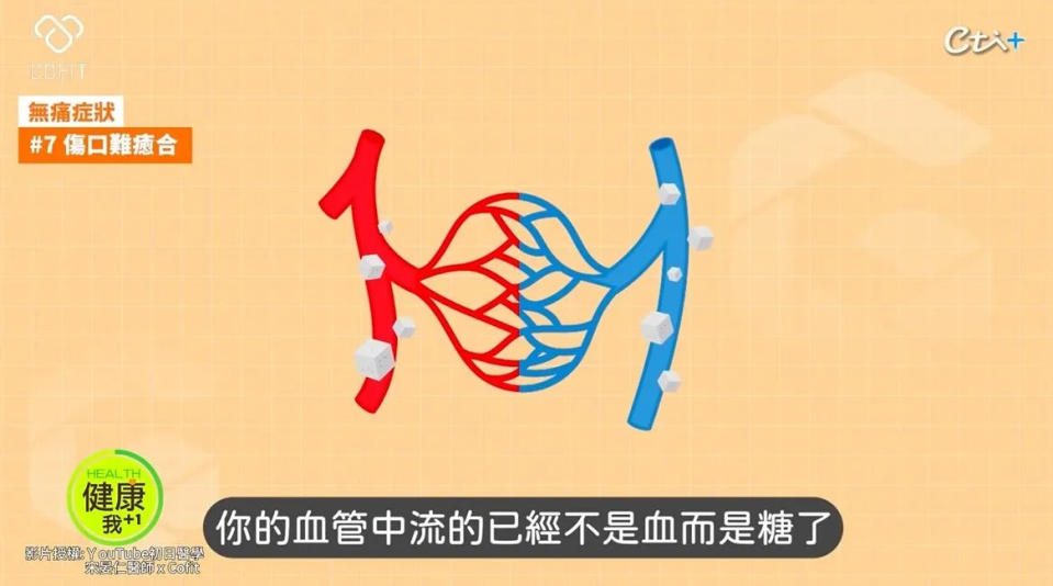  周建安醫師曝光7個恐怖的無痛糖尿病症狀，緊急公開超前3個逆轉糖尿病秘密。（圖／翻攝自初日診所YT頻道）