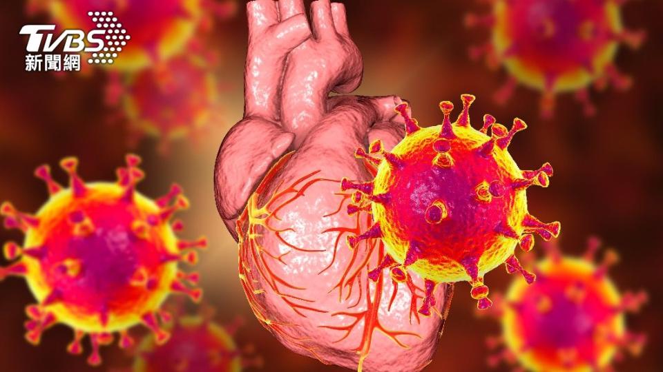 病毒性心肌炎，通常病毒會直接侵犯心肌細胞造成免疫反應。（示意圖／shutterstock達志影像）