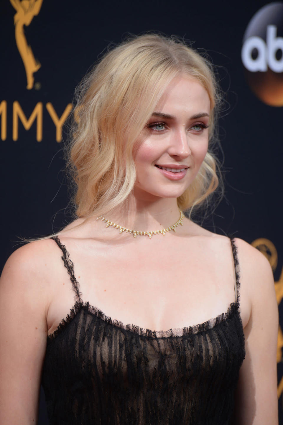 Sophie Turner’s Rosy Eyes