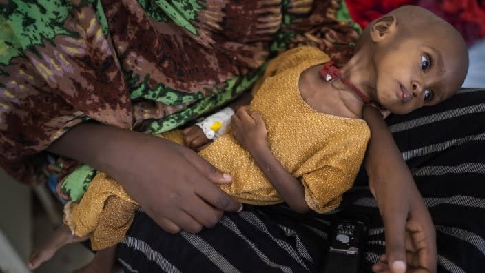 Hamdi Yusuf, a malnourished child, is held by her mother in Dollow, Somalia last month. She was little more than bones and skin when her mother found her unconscious, two months after arriving in the camps and living on scraps of food offered by neighbors. (Photo: Jerome Delay/AP)