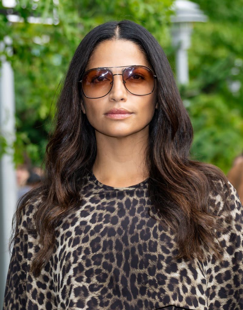 camila alves mcconaughey hair loss transformation