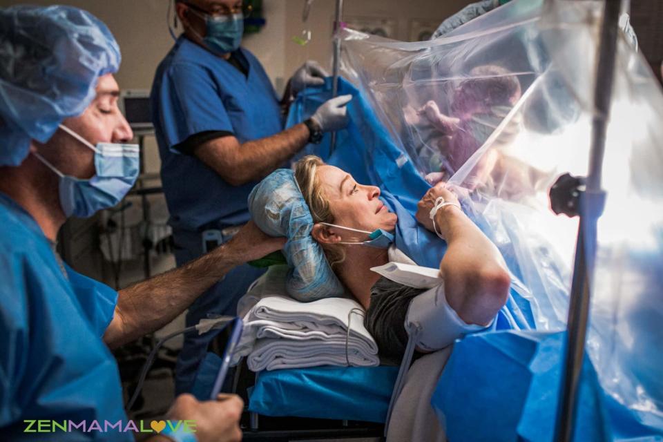 Woman giving birth via C-section with medical team and newborn visible