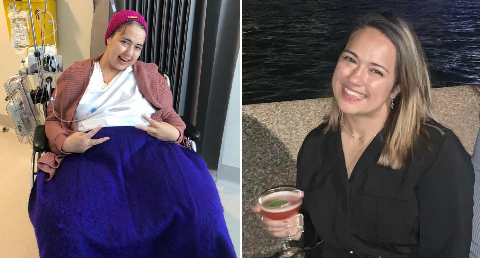 Moana Smith before and after being diagnosed with cancer. 