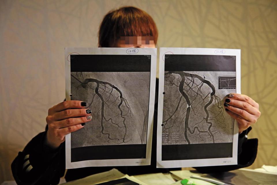 周婦親友質疑，萬芳醫院提供的血管照片疑似經影像處理。