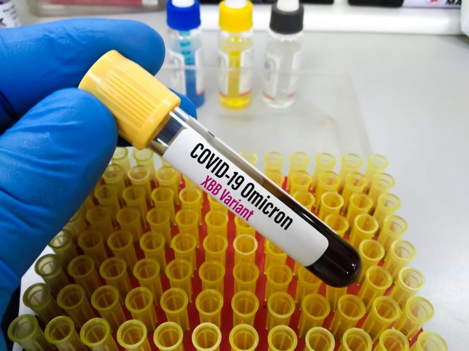 <a href="https://www.shutterstock.com/es/image-photo/blood-sample-labeled-new-variant-omicron-2248547203" rel="nofollow noopener" target="_blank" data-ylk="slk:Shutterstock /Arif biswas;elm:context_link;itc:0;sec:content-canvas" class="link ">Shutterstock /Arif biswas</a>