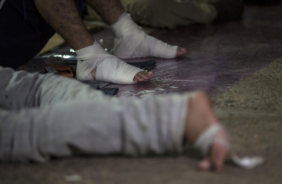 FILE - In this Oct. 26, 2018 file photo, a migrant with bandaged feet rests after walking all day with the U.S.-bound caravan, at a shelter in Arriaga, Chiapas state, Mexico. "These are extreme conditions," says Ignacio Escotto, a Mexican vascular surgeon who specializes in treating extremities. (AP Photo/Rodrigo Abd, File)