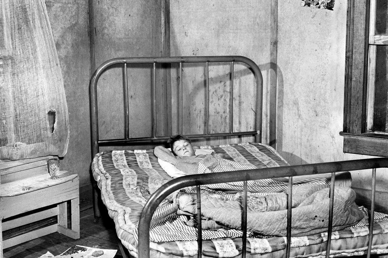 Young Boy in Bed with Measles 1941 Circa Images/GHI/Universal History Archive/Universal Images Group via Getty Images