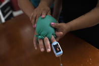 Two latex gloves filled with warm water cover the hand of the husband of nurse Lidiane Melo as she demonstrates at their home in Rio de Janeiro, Brazil, Wednesday, April 14, 2021. In the early days of the pandemic, as sufferers were calling out for comfort that she was too busy to provide, Melo put water-filled gloves on patients' hands to simulate a loving touch. Some have christened the practice the "hand of God," and it is now the searing image of a nation roiled by a medical emergency with no end in sight. (AP Photo/Silvia Izquierdo)