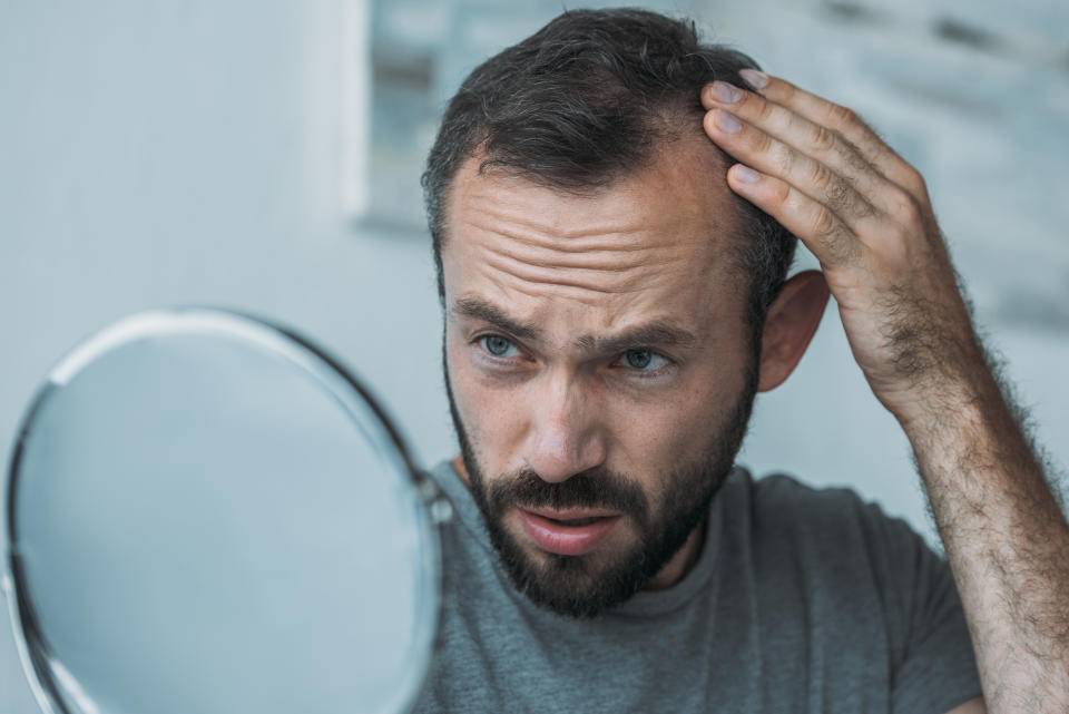 La caída del cabello, el insomnio, la inflamación abdominal, sin algunos de los signos físicos de que los niveles de cortisol están demasiado altos. (Getty Creative)