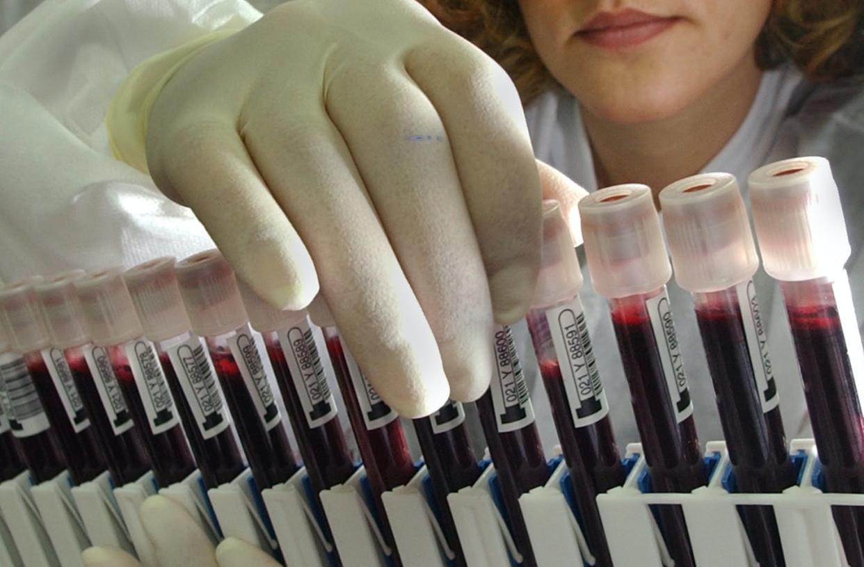 <span class="caption">Researchers can test blood samples taken for other reasons to see if patients have previously had COVID-19.</span> <span class="attribution"><a class="link " href="https://www.gettyimages.com/detail/news-photo/leila-kohbodi-and-melvin-narciso-prepare-viles-of-blood-news-photo/563577159" rel="nofollow noopener" target="_blank" data-ylk="slk:Don Bartletti/Los Angeles Times via Getty Images;elm:context_link;itc:0;sec:content-canvas">Don Bartletti/Los Angeles Times via Getty Images</a></span>