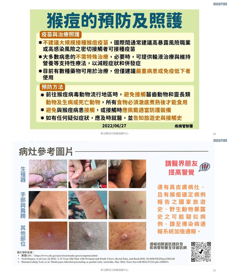 彰化縣新增確診數830例　猴痘傳染病如何預防及照護