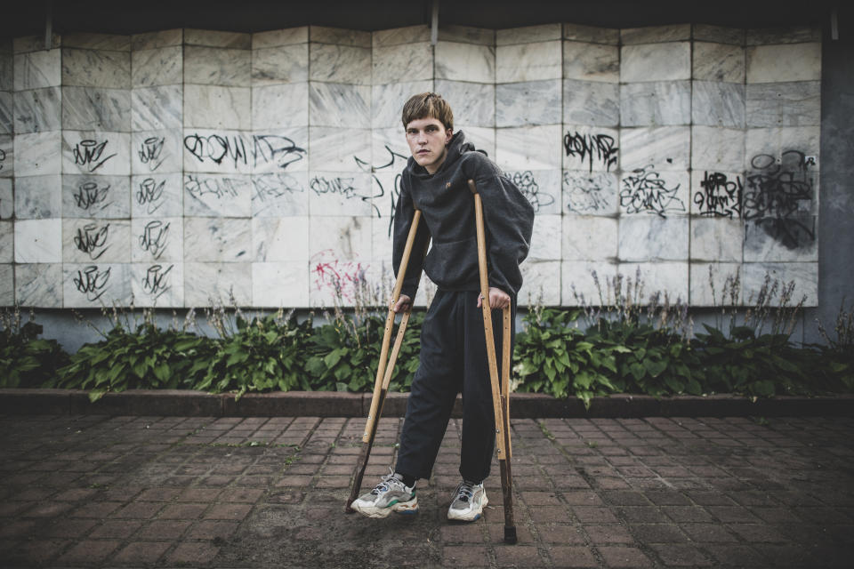 Alexander Laubert, 18, a student poses for a photo Tuesday, Aug. 18, 2020 on crutches due to a broken knee after being beaten by police during a protest in Minsk, Belarus. Wary at first, Laubert eventually opened up about two days of being beaten, trampled on, nearly suffocated and doused in gasoline before volunteers finally brought him to a hospital for treatment and a leg cast. Instead of cowing him, though, the experienced emboldened him. (AP Photo/Evgeniy Maloletka)