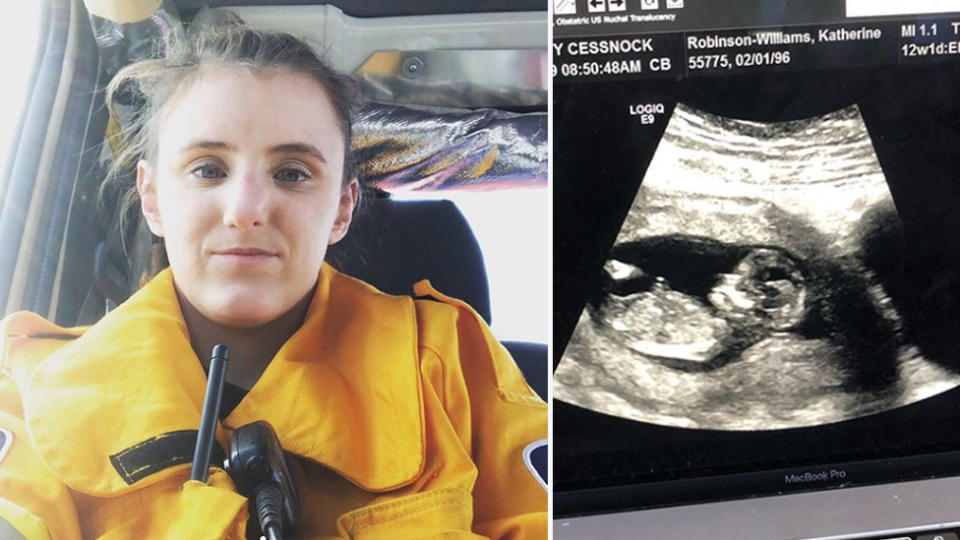 Rural NSW firefighter, Katherine Robinson-Williams, 23, with an ultrasound image of her 13-week-old baby. 