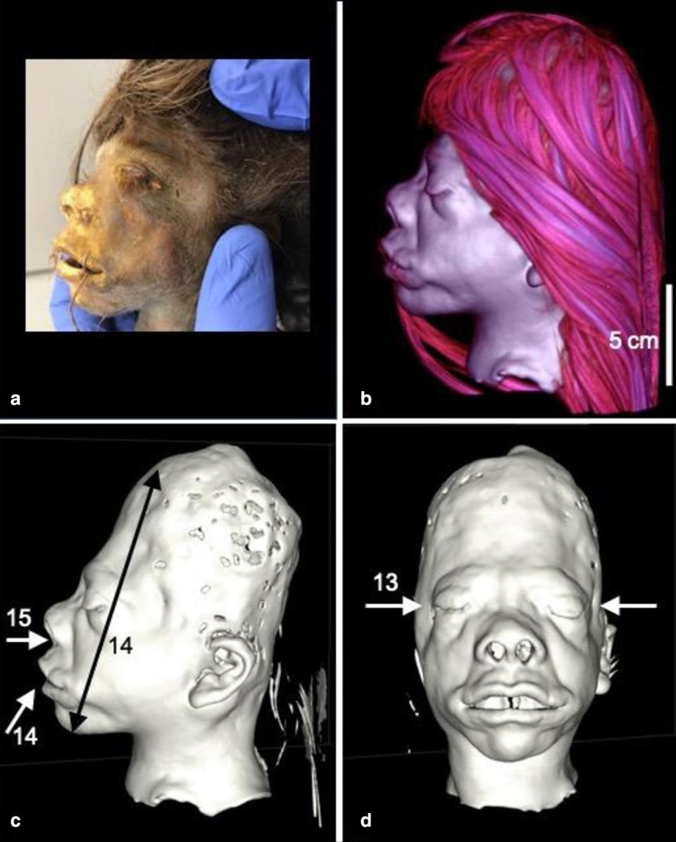 After several scientific tests, researchers established that the object was a human head, probably from a slain enemy. (Byron et al. / Heritage Science)