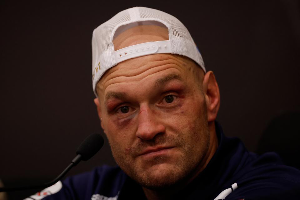 Tyson Fury during his post-fight press conference (Action Images via Reuters)