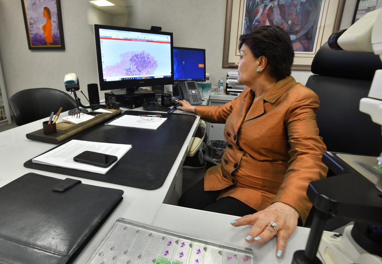 Dr. Shahla Masood is professor and chairwoman of the pathology and laboratory medicine department at the University of Florida College of Medicine-Jacksonville. She is shown with digital scans of tissue samples electronically sent to a New York company for evaluation. The college is using the first federally approved artificial intelligence-based software to help physicians make faster and more accurate breast and prostate cancer diagnoses.