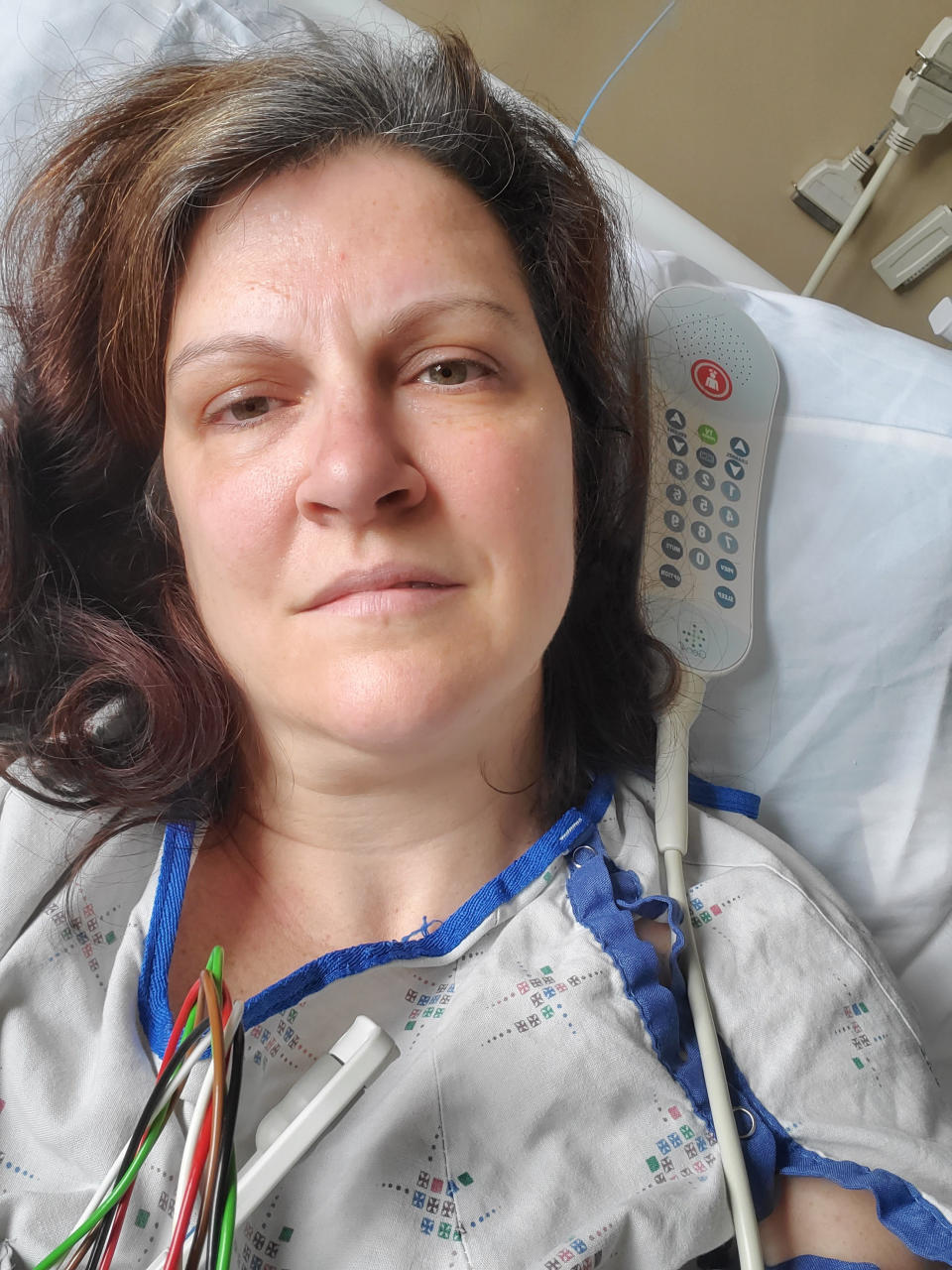 En esta fotografía del 6 de mayo de 2020 facilitada por Darlene Gildersleeve, de 43 años, de Hopkinton, Nueva Hampshire, la muestra cuando estuvo internada en un hospital en Manchester despues de sufrir embolias por unos trombos relacionados con el COVID-19. (Darlene Gildersleeve via AP)