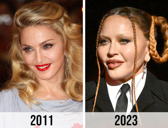 Did Madonna Get Plastic Surgery? Transformation Photos