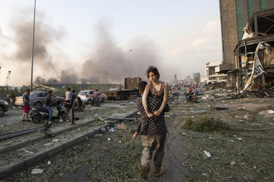 People evacuate wounded after of a massive explosion in Beirut, Lebanon, Tuesday, Aug. 4, 2020. (AP Photo/Hassan Ammar)