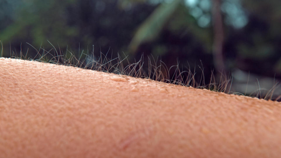 Die Wirkung des Haaraufrichtemuskels ist heute sicher deutlich weniger beeindruckend als bei unseren Vorfahr*innen. (Foto: Getty Images)