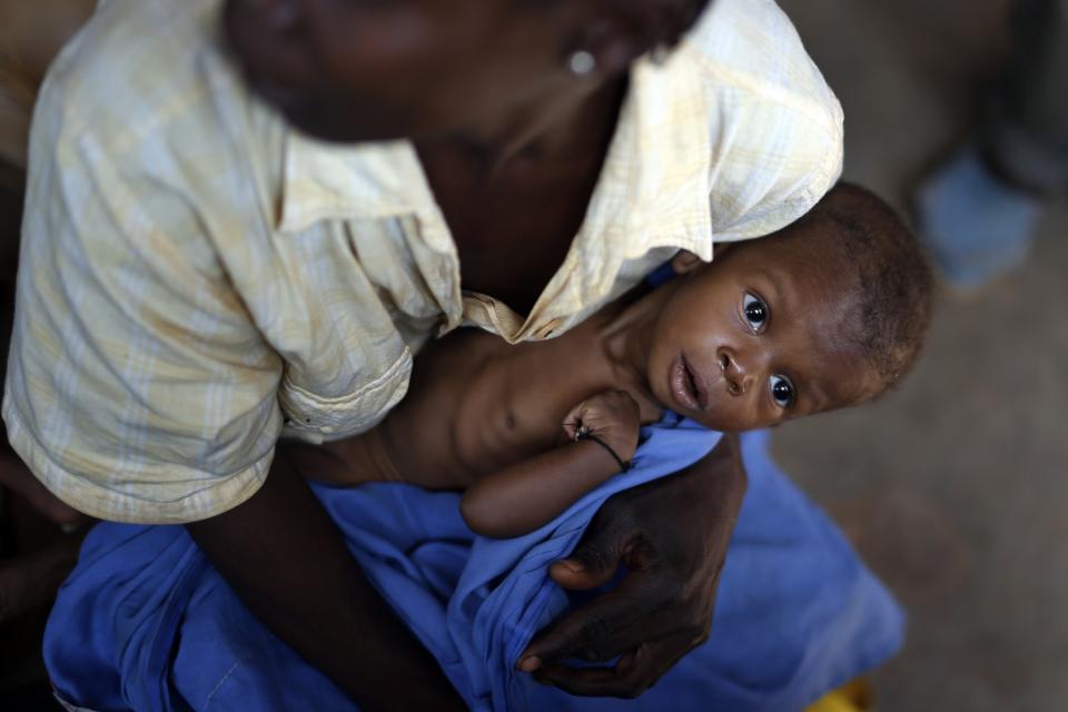 <p>Puesto 1 – República centroafricana<br> Puntuación – 46,1<br> Nota – Las puntuaciones se basan en los siguientes factores: porcentaje de desnutrición entre la población, predominio de emaciación en niños de menos de cinco años, predominio de retraso en el crecimiento en niños de menos de cinco años, índice de mortalidad entre niños de menos de cinco años.<br> Foto – <em>AP</em> </p>