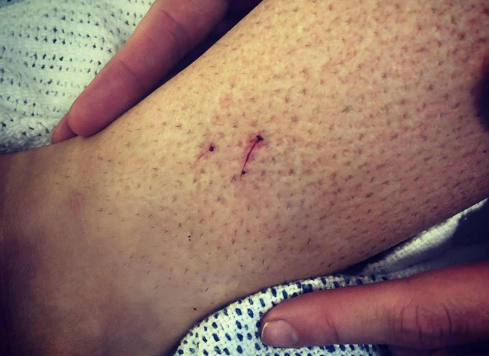 A Dalby paramedic has told of a race against time after she was bitten by a large brown snake outside her home.