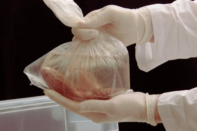 <span class="caption">Purloined organs can fetch a pretty penny on the black market.</span> <span class="attribution"><a class="link " href="https://www.shutterstock.com/image-photo/kidney-transplant-surgery-illegal-transplantation-human-1044717916?src=7HXBa_CIKKh72wbZjQzCdQ-1-73" rel="nofollow noopener" target="_blank" data-ylk="slk:shutterstock;elm:context_link;itc:0;sec:content-canvas">shutterstock</a></span>