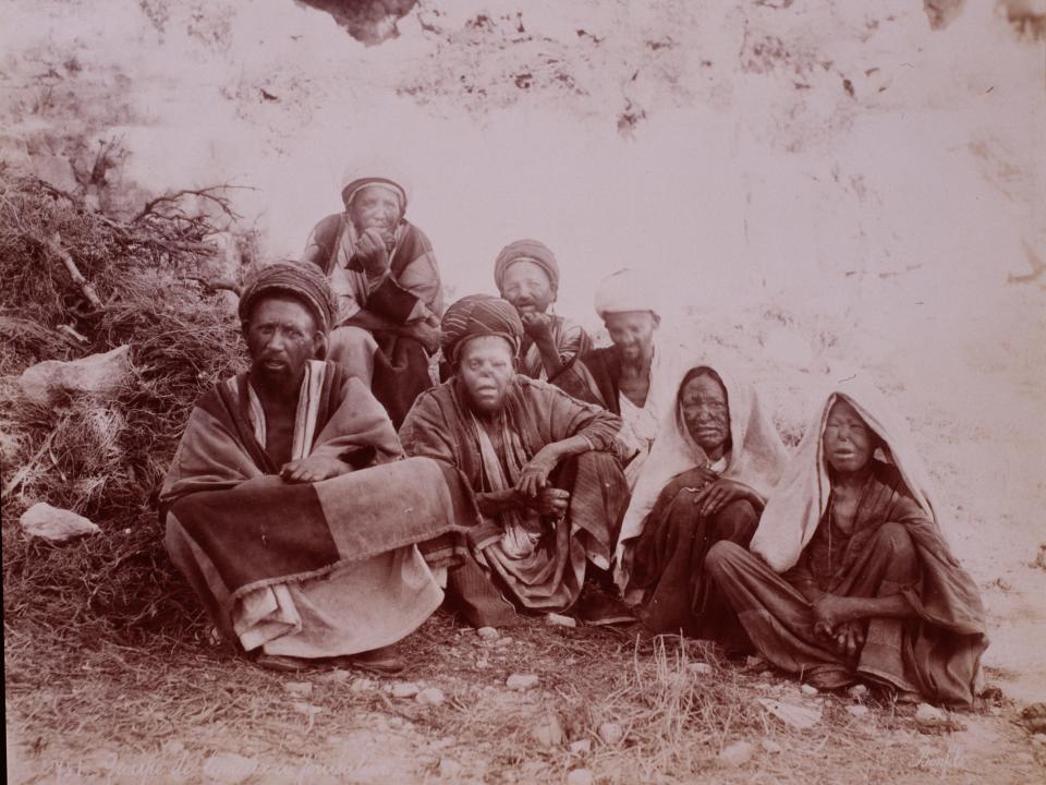 People with leprosy in Jerusalem in the 1870s.