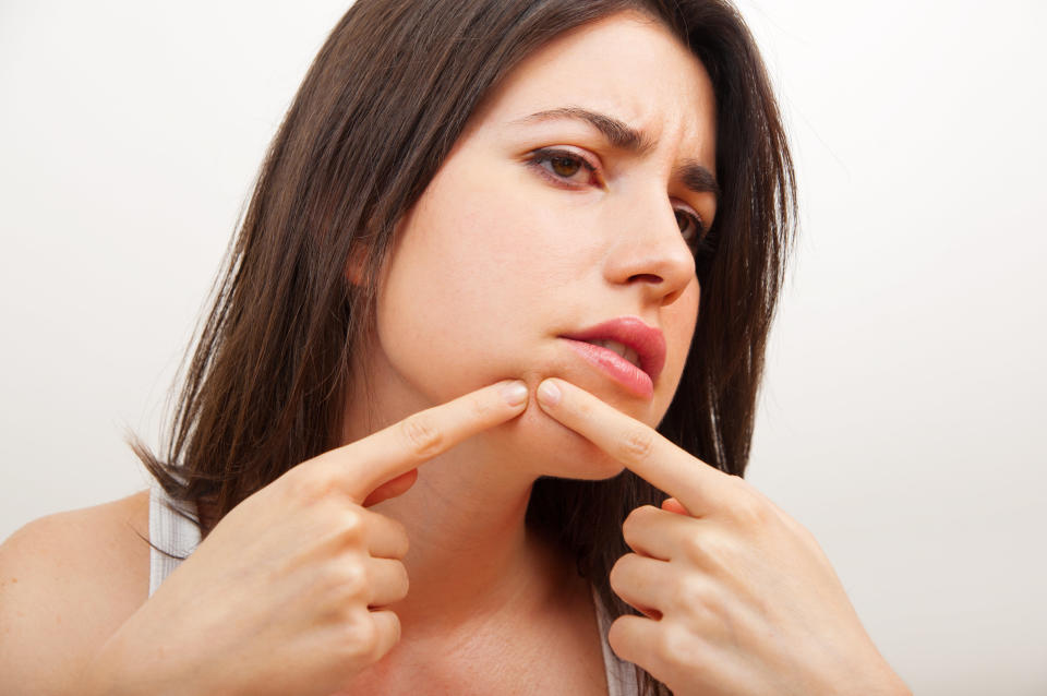 No, no, no! Don't pop your zits. Not only does it increase the chance of scarring, it's also likely that you will worsen the blemish and spread bacteria to other places on your face which could give rise to another breakout.