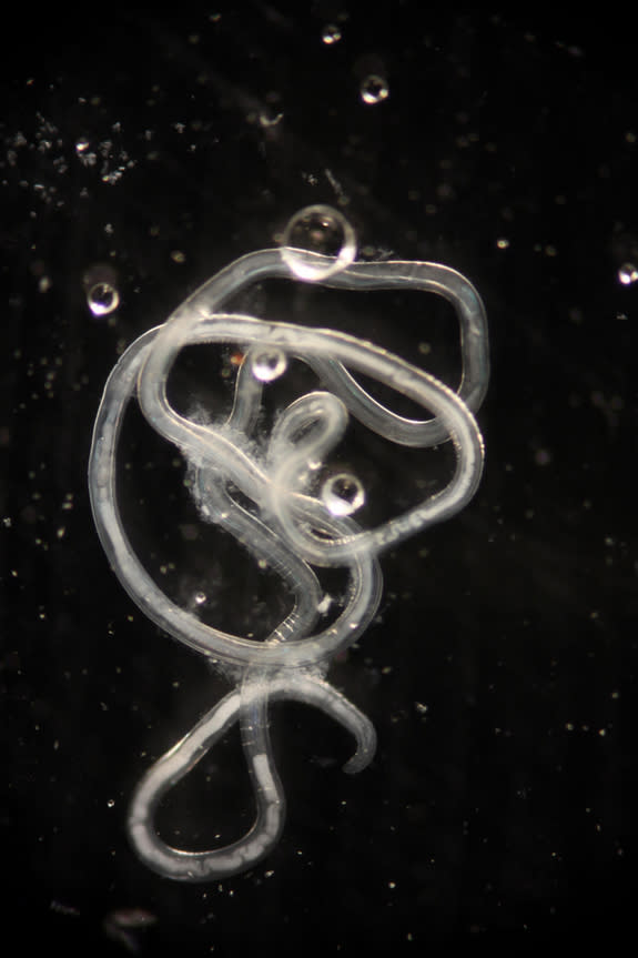 Buddy was removed intact and alive. Jon Allen rushed the nematode to his lab, preserved in a little jar of his own saliva.