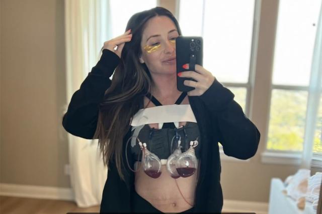 Bristol Palin Reveals She Underwent 9th Breast Reconstruction Surgery to  Fix 'Botched' Reduction