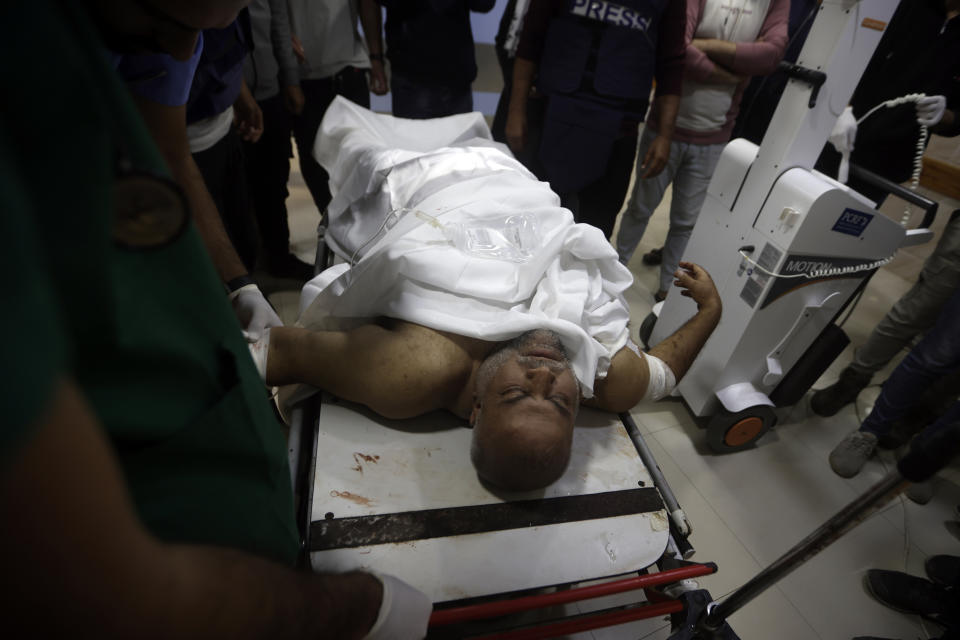 Al Jazeera correspondent Wael Dahdouh is treated at Nasser hospital after being wounded in an Israeli strike in Khan Younis refugee camp, southern Gaza Strip, Friday, Dec. 15, 2023. (AP Photo/Mohammed Dahman)