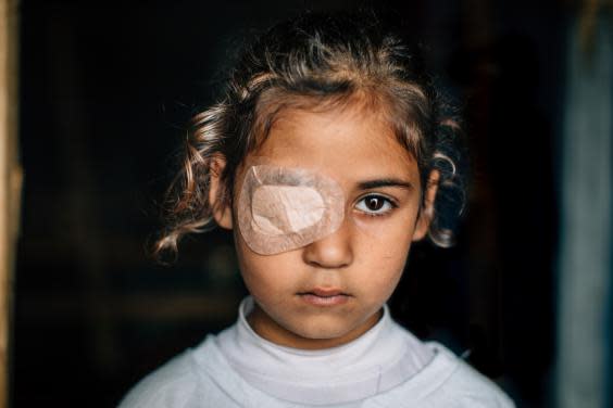 Qaram, 8, is in desperate need of an operation to save her sight (Paddy Dowling)