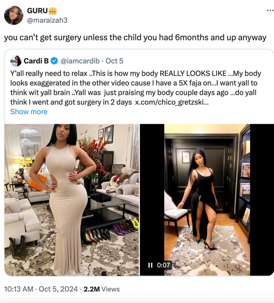 Fan defends Cardi B against plastic surgery accusations (X/@maraizah3)