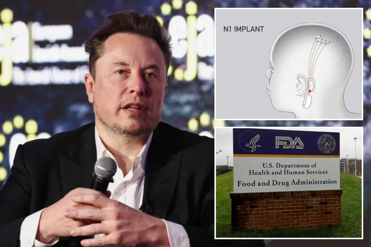 Brain implant illustration, Elon Musk and FDA headquarters