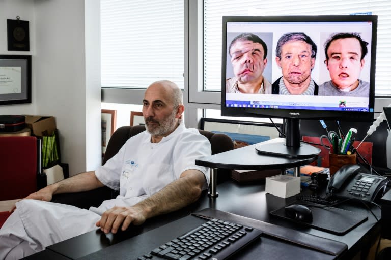 le Pr Laurent Lantieri, spécialiste de la greffe de main et de visage, à côté d'un écran montrant les différentes étapes de l'opération de son patient Jérôme Hamon, à l'hôpital européen Georges-Pompidou, le 13 avril 2018 à Paris (AFP/Archives - Philippe LOPEZ)