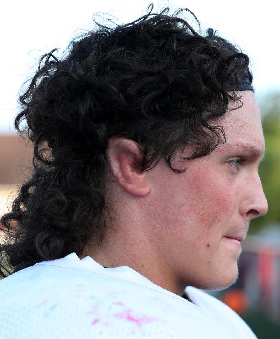 Wadsworth's Kyle Figuary shows his right ear, which was surgically constructed when he was a child.