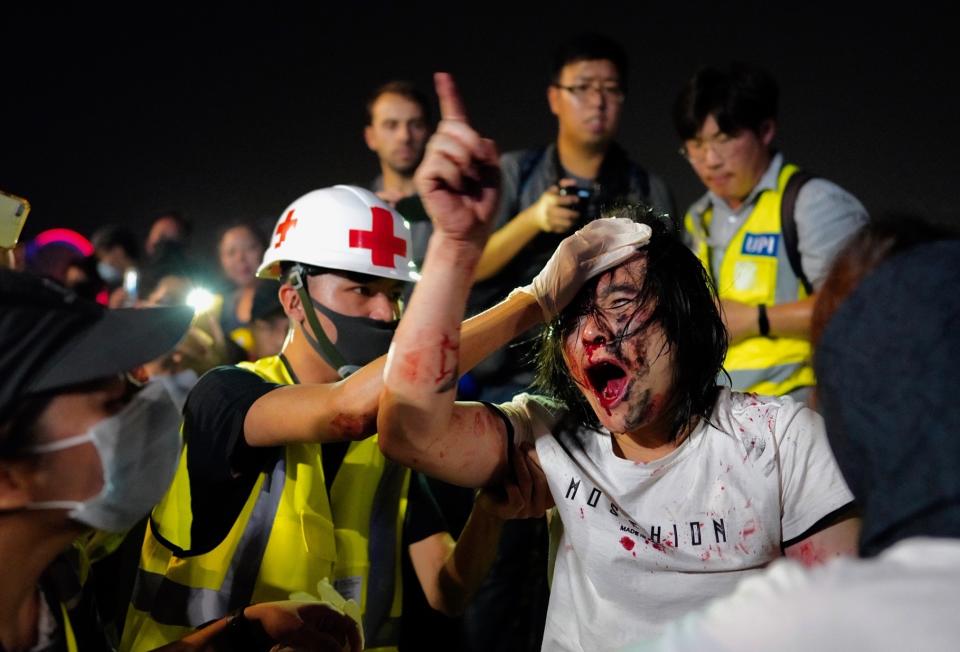 A medic treats a pro-Beijing man after he was hit by protesters for waving a Chinese national flag during a rally at Tamar park in Hong Kong, Saturday, Sept. 28, 2019. Thousands of people gathered Saturday for a rally in downtown Hong Kong, belting out songs, speeches and slogans to mark the fifth anniversary of the start of the 2014 Umbrella protest movement that called for democratic reforms in the semiautonomous Chinese territory. (AP Photo/Vincent Yu)