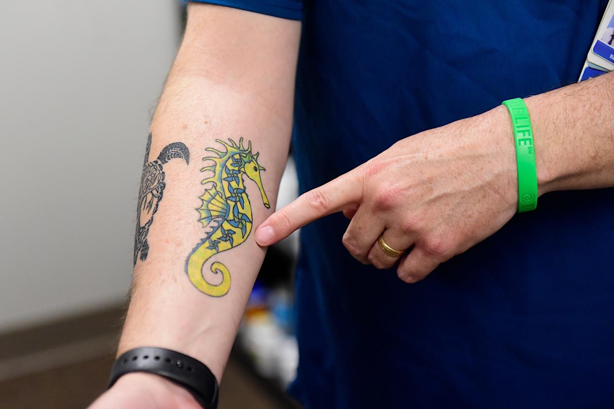 After his laser ablation, Brian George had a seahorse tattooed on his right forearm. The seahorse has become symbolic for epilepsy patients, since the disease affects a person's hippocampus, which is a portion of the brain shaped like a seahorse.
